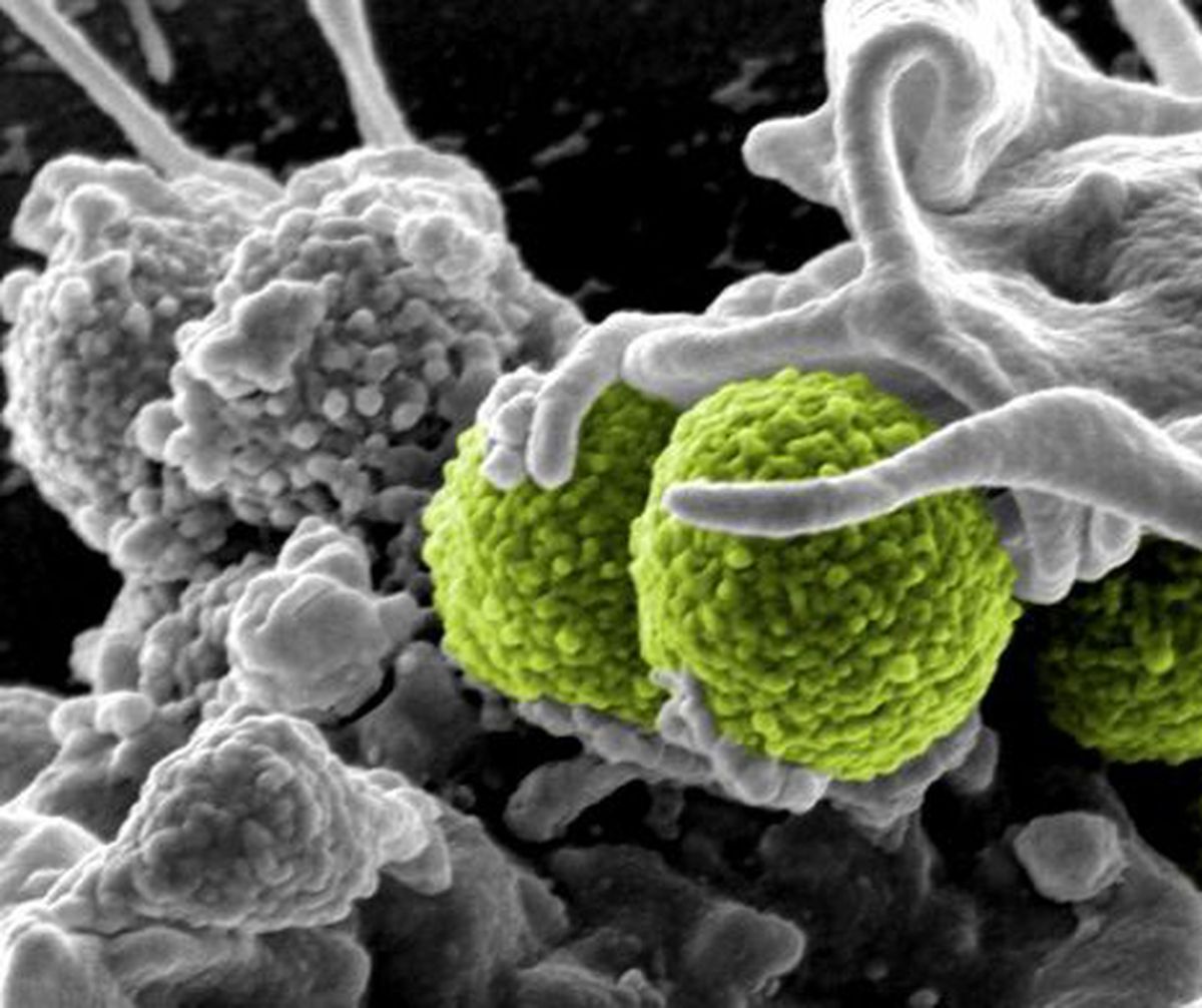 pisici: pot purta super-bacterii, ca nosocomialele